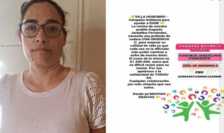 VENDEN EMPANADAS PARA PODER ACCEDER A UNA PRÓTESIS